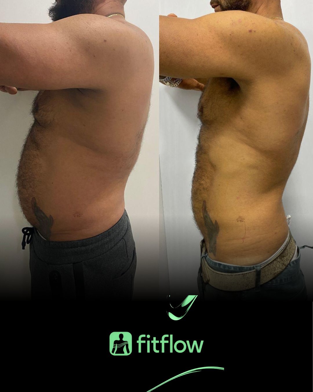 Antes e depois